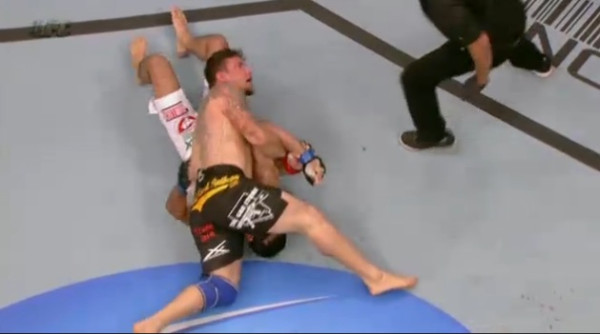 UFC 140 Minotauro Broken Arm 6